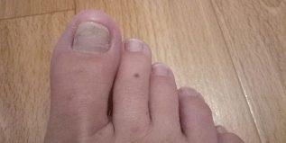 Anerer sprooch liesen